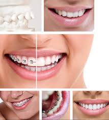 Any pain and discomfort experienced during braces treatments may be resolved through analgesics. Champsaur Dental Clinic Orthodontics In Panama