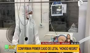 Se detectó un nuevo caso de un paciente diagnosticado con hongo negro y se encuentra internado el director de comeri, ricardo araújo aseguró a informativo uruguay que este tipo de casos se da. 4u1x2mxga0ganm