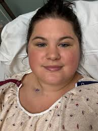 What are some creative ways to explain a neck scar from surgery?