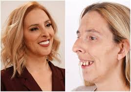 Depois quase 20 anos juntos, mariza liz e tiago pais dias dias usaram a conta oficial de instagram dos amor electro para anunciar o fim da . Irreconhecivel Cristina Ferreira Muda Rosto De Mulher Veja O Antes E O Depois