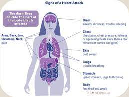 Heart Attack Symptoms Woman Heart Attack Symptoms Stroke Symptoms Heart Attack