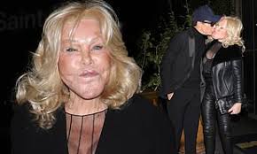 Jocelyn Wildenstein