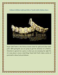 No matter what i did, gran would call me out. Royal Gold Teeth Grillz