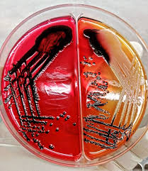 Image result for Stool Culture