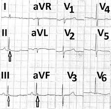 Image result for J Wave