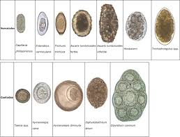 laboratory diagnosis of parasites from the gastrointestinal