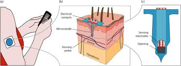 It does this using arrows next to the reading indicating whether your levels are dropping or rising. Real Time Intradermal Continuous Glucose Monitoring Using A Minimally Invasive Microneedle Based System Springerlink