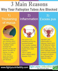 Maybe you would like to learn more about one of these? Energy Exercises To Open Blocked Fallopian Tubes Naturally Fallopian Tubes Blocked Fallopian Tubes Fallopian Tube Blockage
