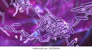 Image result for Erysipeloid