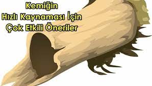 Kirilan Kemigin Cabuk Kaynamasi Icin Ne Yemeli Kirigin Hizli Kaynamasi Icin Beauty Advice Health Beauty