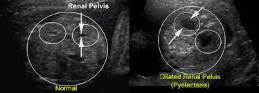 Genetic Sonography Routine Ultrasound