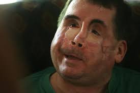 Injured Belleville cop is tough — and he needs to be