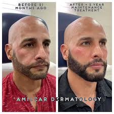 Amílcar G. Rodríguez,MD,FAAD (@amilcardermatology) • Instagram photos and  videos