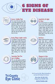 Pin By Tri County Eye Clinic On Tips From Tri County Eye Clinic Eyes Problems Clinic Eyes