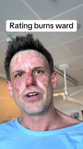 Experiences in the Burns Ward: A Cautionary Tale