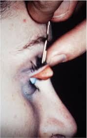 I love the kid doing the eyelid flip and the markers in the nose, all those little things. Eye Images