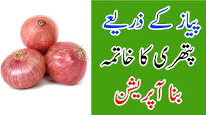 Kidney Stone Treatment In Urdu Kidney Stones Treatment In Urdu Kidney Stones Removal Cure In Urdu Youtube