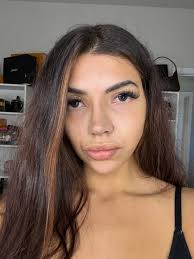 Will the dent go away? Im 2 weeks post op