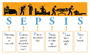Image result for Sepsis