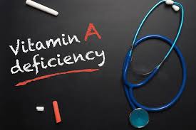 Image result for Vitamin Deficiency