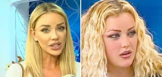 We did not find results for: Cum ArÄƒta Bianca DrÄƒguÈ™anu Inainte De Primul Milion De OperaÈ›ii Estetice Kmkz Ro