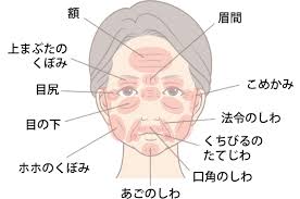 注射式しわ取り シワ取り 長期持続型ヒアルロン酸注入 肌 美容皮膚科 美容整形の高須クリニック 美容整形 皮膚科 しわ