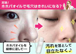 これ1本あれば何とかなる 今回は 万能すぎる無印良品のホホバオイルを特集 毛穴をきれいにする方法やにきびへの効果まで お悩み解決実験は必見です フェイスケア スキンケアのアドバイス スキンケア