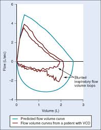 Peak Expiratory Flow An Overview Sciencedirect Topics