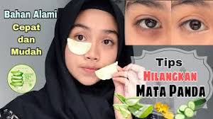 Cara hilangkan dark circle, mata panda dan wrinkles. Macam Mana Nak Hilang Kan Dark Circle And Eyebag Mawar Sharing Cute766