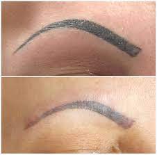 5 eyebrow 'before and after' transformations that prove any brow can be saved. Microblading Vs Eyebrow Tattoo Key Differences Pmuhub