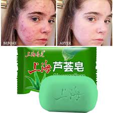 Eco style gel black castor & flaxseed oil, 32 oz (including double sided edge control hair brush, 3 piece rat tail hair. 99 Aloe Soothing Gel Aloe Vera Gel Skin Care Remove Acne Soap Moisturizing Body And Facial Soap Sunscreen Aloe Gel 85g Soap Aliexpress