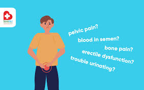 The pancreas is a bodily organ that few people think about. When Prostate Cancer Attacks Manilamed