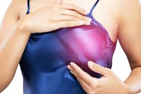 Hal ini bisa membantu mengurangi rasa nyeri pada payudara lantaran olahraga memproduksi endorphin, pembunuh rasa sakit alami di tubuh kita. Payudara Sering Terasa Nyeri Awas Jangan Jangan Ini Penyebabnya