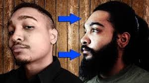 We did not find results for: Minoxidil Beard Success Stories Real Results With Before And After Pictures Stubblehub