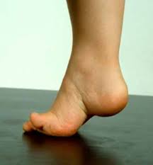 Charcot Marie Tooth Disease Medlineplus Genetics