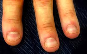 Image result for Mees Line