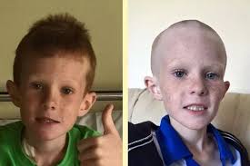 Cameron Rowley, eight, battles rare form of cancer