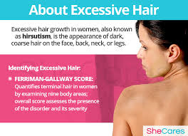 Generally, it responds to treatment. Excessive Hair Shecares