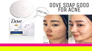 Though both products share the same dove name, both are registered trademarks owned by different companies. What Is The Situation With Dove Soap I Understand It S Not Soap So Is It No Good To Remove Coronavirus From Your Hands Quora