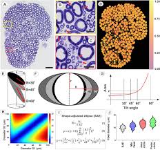 Ytong commercialise plusieur type de bloc de béton cellulaire. A Shape Adjusted Ellipse Approach Corrects For Varied Axonal Dispersion Angles And Myelination In Primate Nerve Roots Scientific Reports