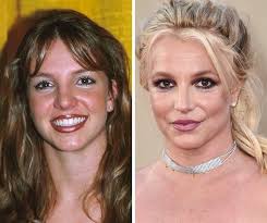 My friend called me and said, 'i need you. 17 Now And Then Pictures Of Celebrities Wow Gallery