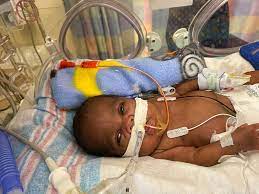 Menino Nasce No Alabama Apos 21 Semanas De Gestacao E Bate Novo Recorde De Mais Jovem Bebe Prematuro A Sobreviver Mundo G1