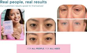 Amazon.com: Frownies Under Eye Gel Patches for Puffy Eyes