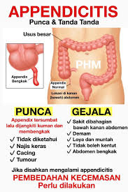 Sebab perasaan tidak nyaman tersebut diduga berasal dari sel kanker yang menginvasi tubuh. Public Health Malaysia Sekiranya Anda Disahkan Mengalami Appendicitis Rawatannya Utamanya Adalah Pembedahan Kecemasan Selain Antibiotik Sekiranya Tidak Dilakukan Apendiks Yang Sedang Membengkak Boleh Pecah Dan Kuman Dari Jangkitan Apendiks Akan