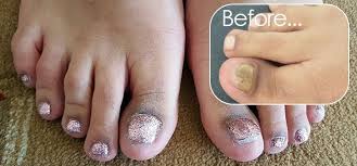 You don't have to get them where they are too long but just so that they look natural. Acrylic Toe Nails Services In Halifax Amandas Amazing Nails