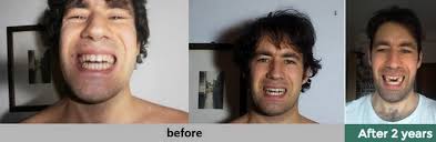 If you're concerned about the possibility of cracking your skull, soak your head in a bucket of warm water and epson salt for about an hour before using the vice. How To Develop Widen And Make Your Face More Symmetrical