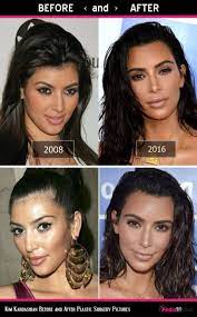 21.10.2021 · we've done some sleuthing on the reality babe's cosmetic procedures, possible plastic surgery, weight loss hacks and makeup tricks. Kim Kardashian Face Pics Plastic Surgery Before And After Photo 5 Kardashian Plastic Surgery Plastic Surgery Pictures Kim Kardashian Before