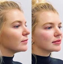 NIMA Institute & Spa