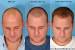 2 Guard Buzz Cut