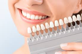 Made from specially created resins, composite veneers similarly to natural teeth, veneers are vulnerable to cracks and chips. What Is The Hollywood Smile The Magic That Is Veneers On Teeth Medstarhc